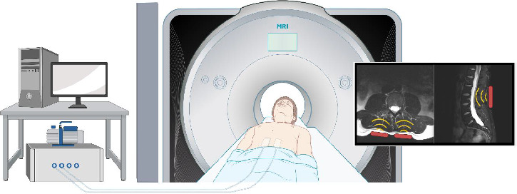 Assessing Intervertebral Disk Tissue Mechanics Using Dual-Actuator Multifrequency Magnetic Resonance Elastography: Case Reports.