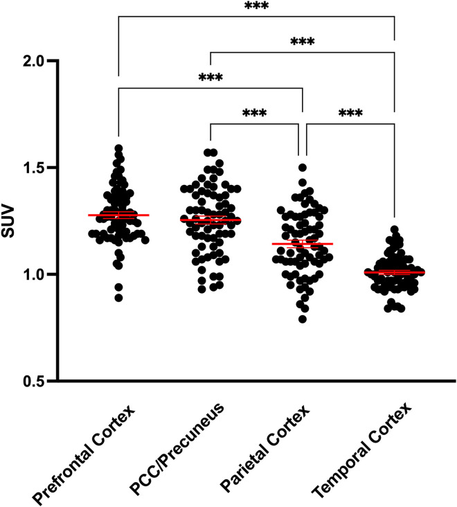 The relationship of <sup>18</sup>F-FDG-PET to other common biomarkers of dementia in a clinical cohort with memory deficits.