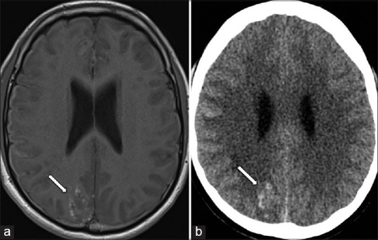 Clinics in diagnostic imaging (222).