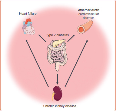 Cardiovascular Risk Reduction in Patients with Type 2 Diabetes: What Does the Cardiologist Need to Know?
