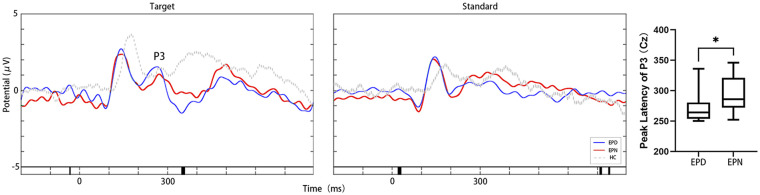 Event-related potential biomarkers in temporal lobe epilepsy: N170, vertex positive potential, late positive potential, and P3 signatures of depression comorbidity.