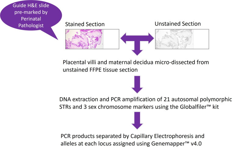 Morphology combined with <i>HER2</i> D-DISH ploidy analysis to diagnose partial hydatidiform mole: an evaluation audit using molecular genotyping.