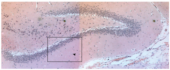 Effect of Cilostazol and Aspirin During Hyperacute Stroke Phase in Rats: An Experimental Research Study.