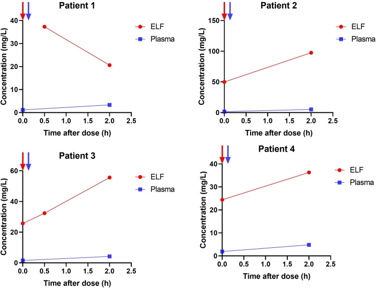 Aerosolized delivery resulting in high polymyxin B concentration levels in epithelial lining fluid ensures efficacy in ventilator-associated pneumonia.