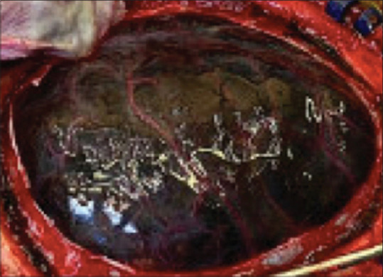 Clinics in diagnostic imaging (222).