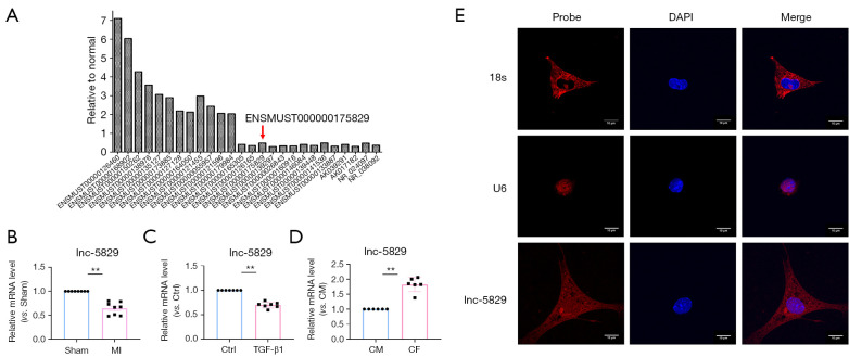 LncRNA-5829: a novel inhibitor of cardiac fibrosis.
