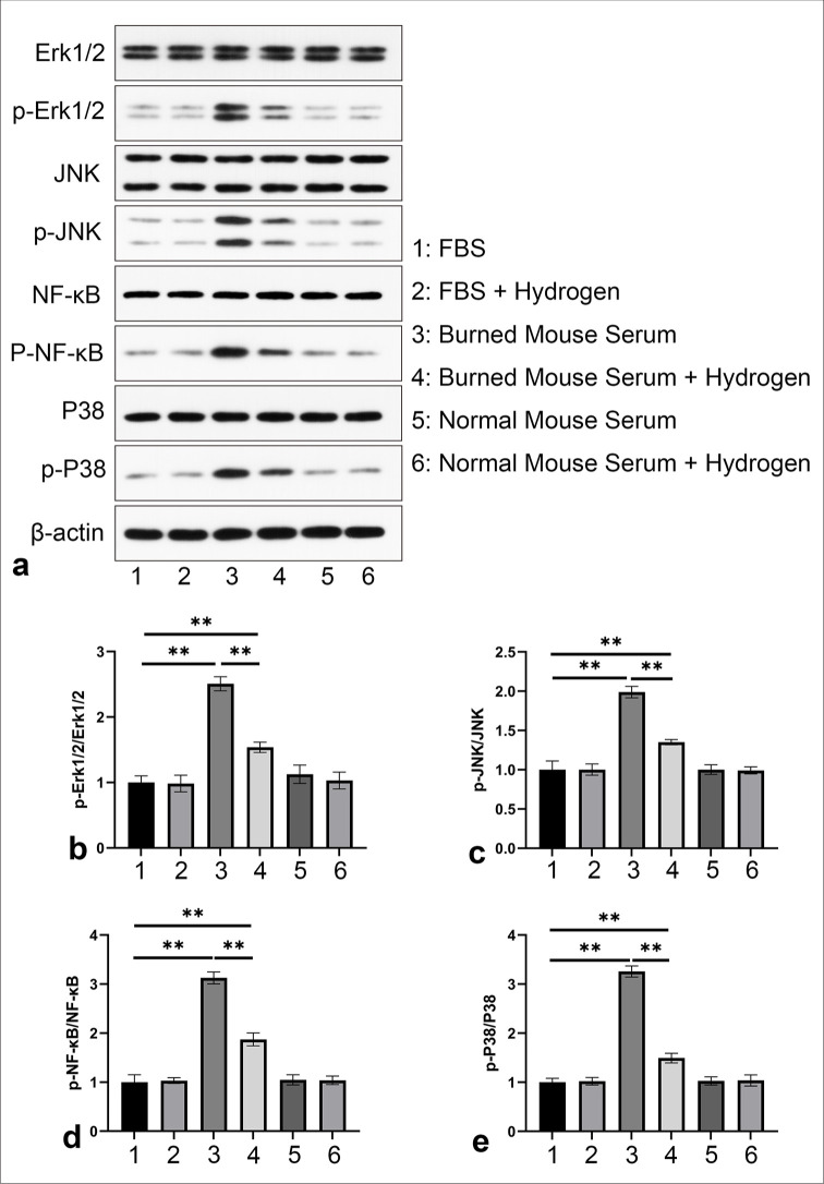 Hydrogen gas therapy: A promising approach for sepsis management post-burn injury by modulating inflammation, oxidative stress, and wound healing.