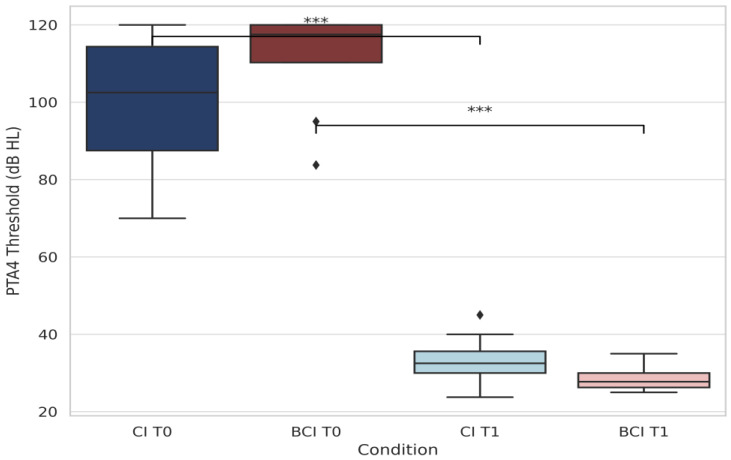 Cochlear and Bone Conduction Implants in Asymmetric Hearing Loss and Single-Sided Deafness: Effects on Localization, Speech in Noise, and Quality of Life.