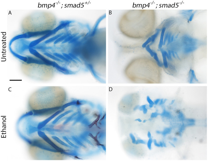 Mutations in the bone morphogenetic protein signaling pathway sensitize zebrafish and humans to ethanol-induced jaw malformations.