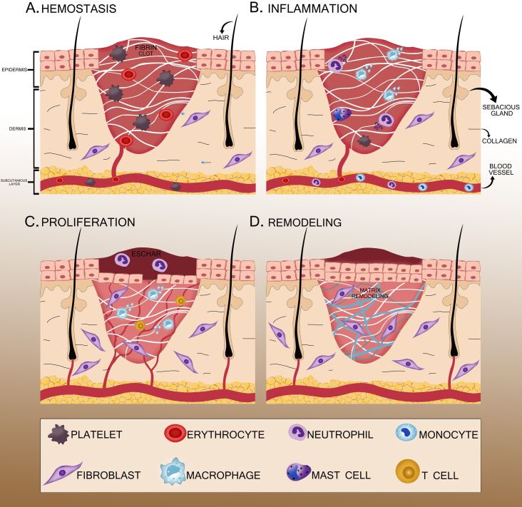 Polyurethane/silk fibroin-based electrospun membranes for wound healing and skin substitute applications.