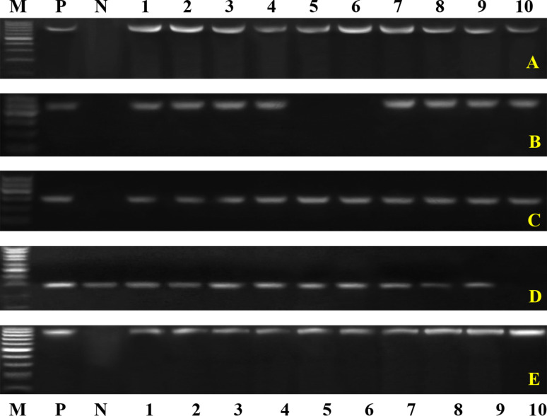 Single nucleotide polymorphisms, gene expression and evaluation of immunological, antioxidant, and pathological parameters associated with bacterial pneumonia in Barki sheep.