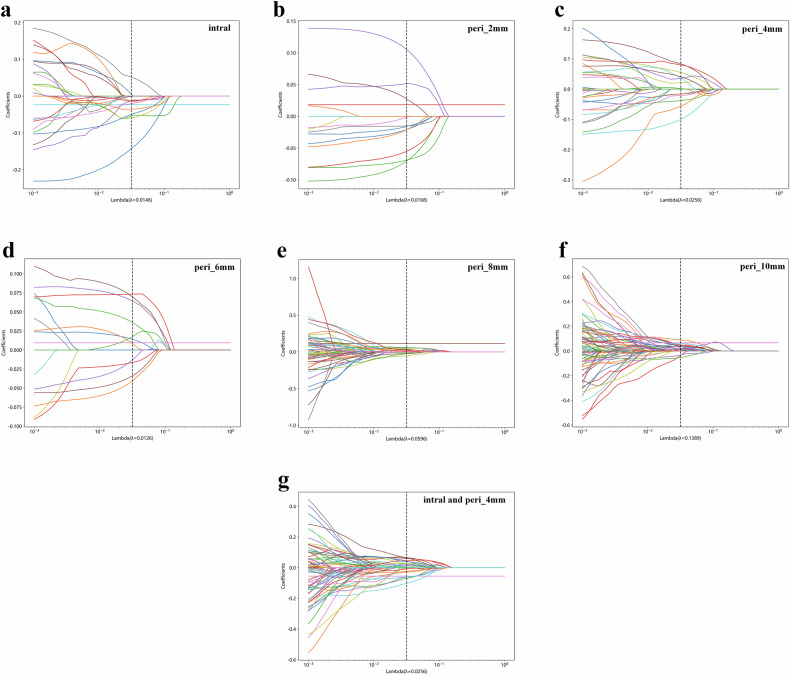 Early treatment monitoring of multidrug-resistant tuberculosis based on CT radiomics of cavity and cavity periphery.