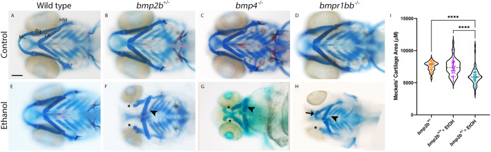 Mutations in the bone morphogenetic protein signaling pathway sensitize zebrafish and humans to ethanol-induced jaw malformations.