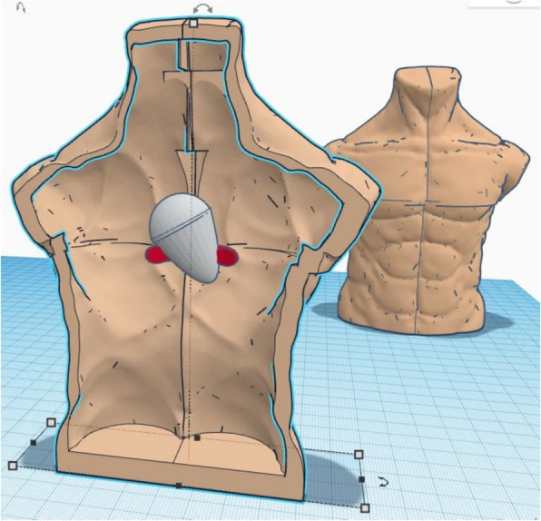 Innovative approaches to pericardiocentesis training: a comparative study of 3D-printed and virtual reality simulation models.