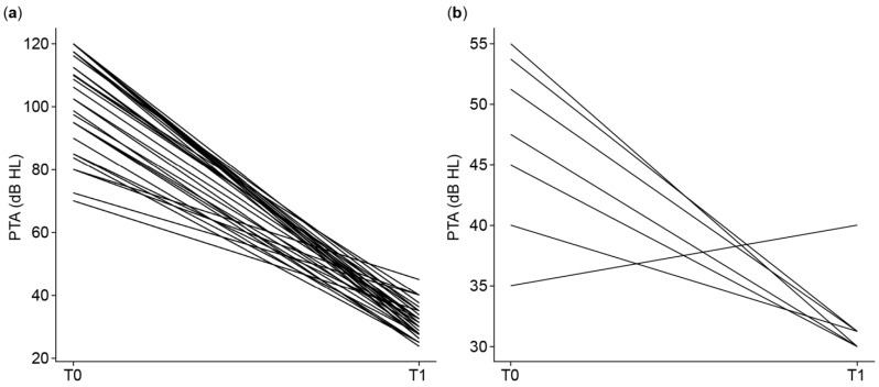 Cochlear and Bone Conduction Implants in Asymmetric Hearing Loss and Single-Sided Deafness: Effects on Localization, Speech in Noise, and Quality of Life.
