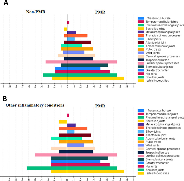 Whole-body and site specific [<sup>18</sup>F]FDG uptake patterns on PET/CT have limited value in differentiating between polymyalgia rheumatica and other inflammatory diseases: two cohorts of treatment-naïve suspected polymyalgia rheumatica.