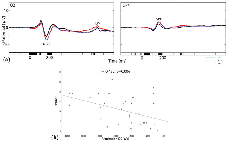 Event-related potential biomarkers in temporal lobe epilepsy: N170, vertex positive potential, late positive potential, and P3 signatures of depression comorbidity.
