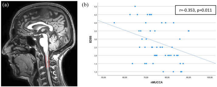 Aerobic capacity moderates the association between cervical cord atrophy and clinical disability in mildly disabled multiple sclerosis patients.