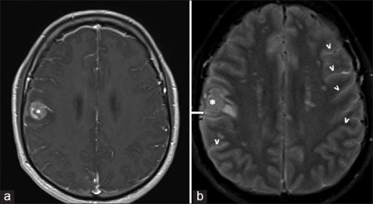 Clinics in diagnostic imaging (222).