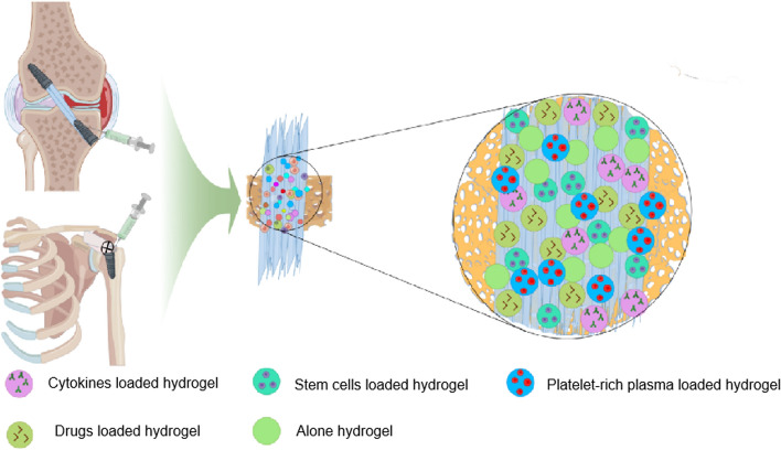 Application and optimization of bioengineering strategies in facilitating tendon-bone healing.