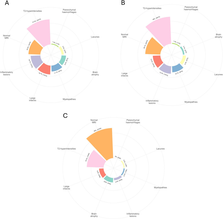 Can conventional brain MRI support the attribution process in neuropsychiatric SLE? A multicentre retrospective study.