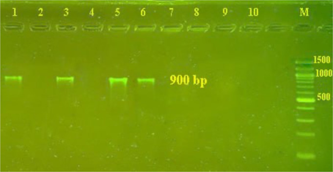 Identification of <i>Entamoeba</i> Species in Diarrheal Samples Using Sequence Analysis and Nested Multiplex PCR.