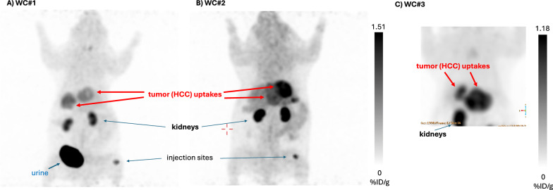 PET imaging of hepatocellular carcinoma with [<sup>124</sup>I]IV-14.