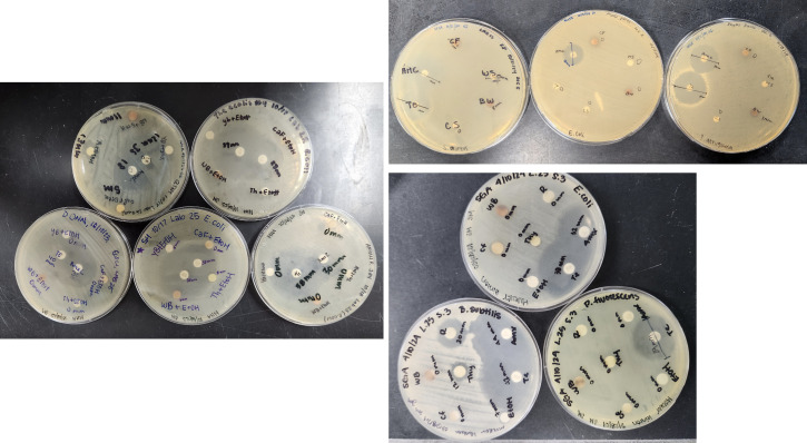 Cultural incorporation of the Kirby-Bauer method in introductory microbiology lab.