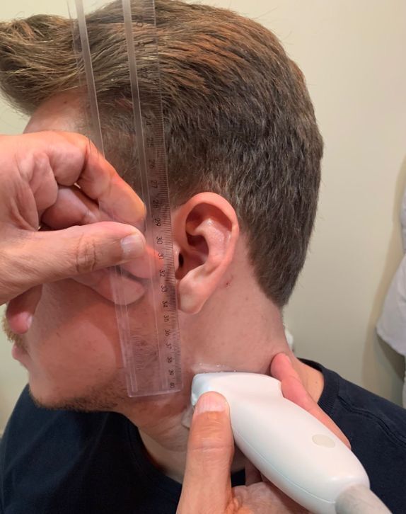 Anatomic evaluation of the height of the carotid bifurcation by 4<sup>th</sup> year medical students using vascular ultrasonography.