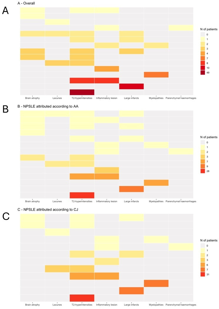 Can conventional brain MRI support the attribution process in neuropsychiatric SLE? A multicentre retrospective study.