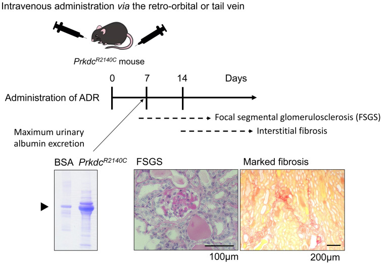 Adriamycin-induced nephropathy models: elucidating CKD pathophysiology and advancing therapeutic strategies.