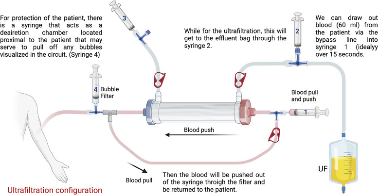 Emergency Renal Replacement Therapy with Manual Dialysis in Patients with Acute Kidney Injury: First-in-Human Case Report.