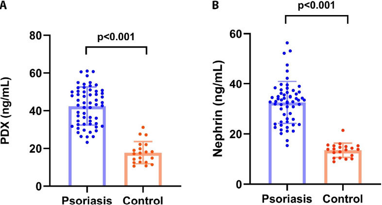 Renal Implications of Psoriasis: Urinary Podocyte Markers and Disease Progression.
