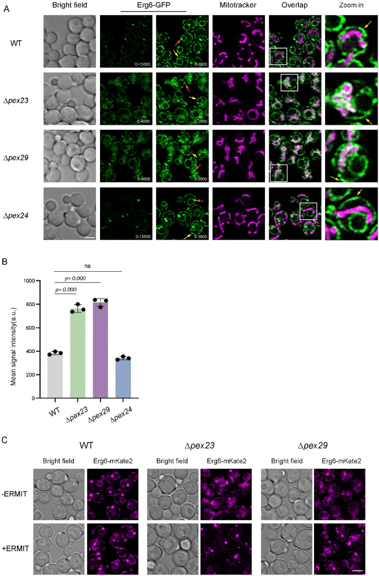 Artificial ER-Mitochondrion Tethering Restores Erg6 Localization and Lipid Droplet Formation in <i>Hansenula polymorpha Δpex23</i> and <i>Δpex29</i> Cells.
