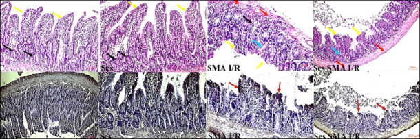 The protective effects of sesamin on the ileum in superior mesenteric artery ischemia induced in rats.