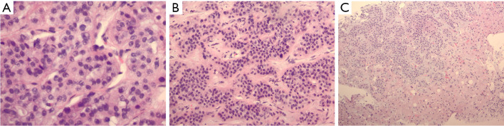 Humor me with calcium: a case report of humoral hypercalcemia of malignancy secondary to cholangiocarcinoma.