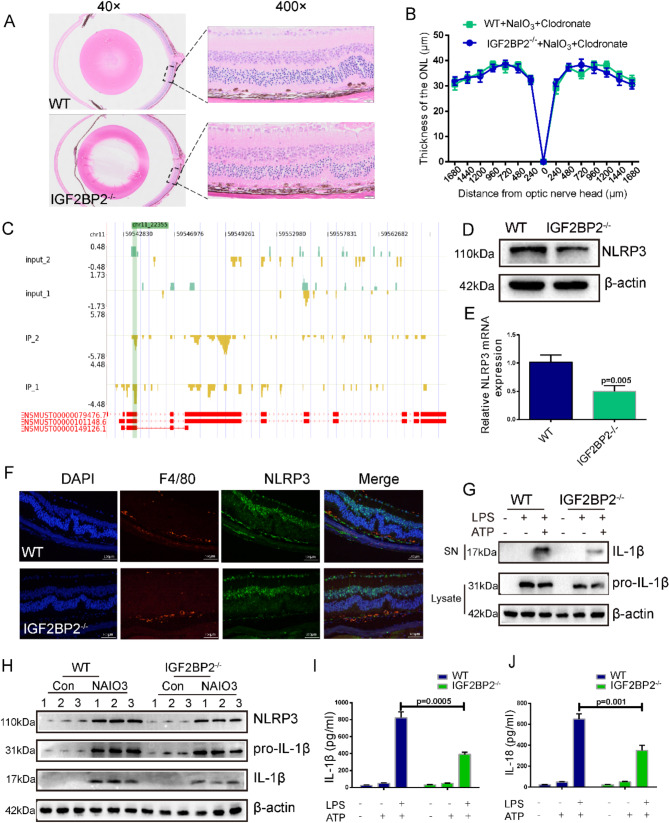 The role of IGF2BP2 in macrophage-mediated NLRP3 inflammasome activation in the pathogenesis of dry AMD.
