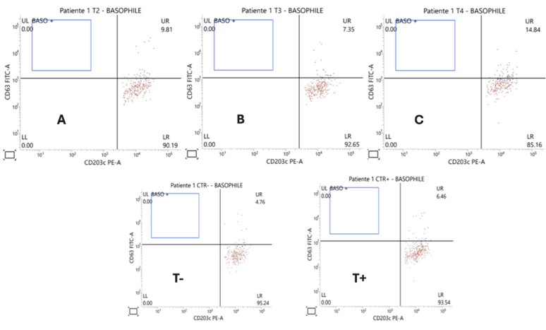 Drug hypersensitivity to vancomycin confirmed by basophil activation test: case report.