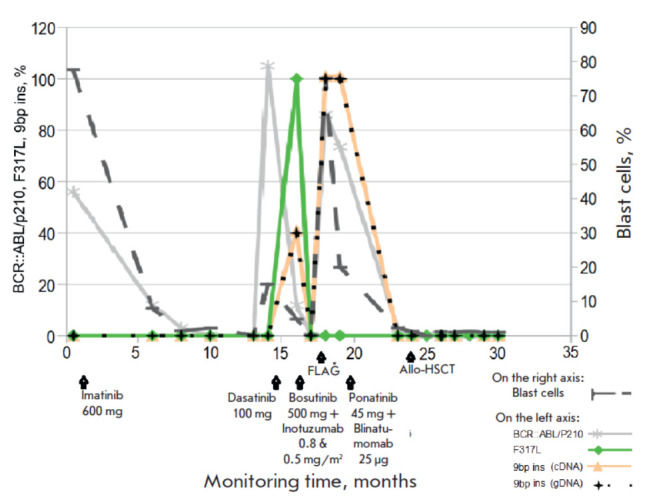 The Emergence of a Novel Insertional Mutation in the BCR::ABL/p210 Oncogene in B-Cell Acute Lymphoblastic Leukemia (B-ALL) Correlates with the Development of Resistance to Several Tyrosine Kinase Inhibitors.