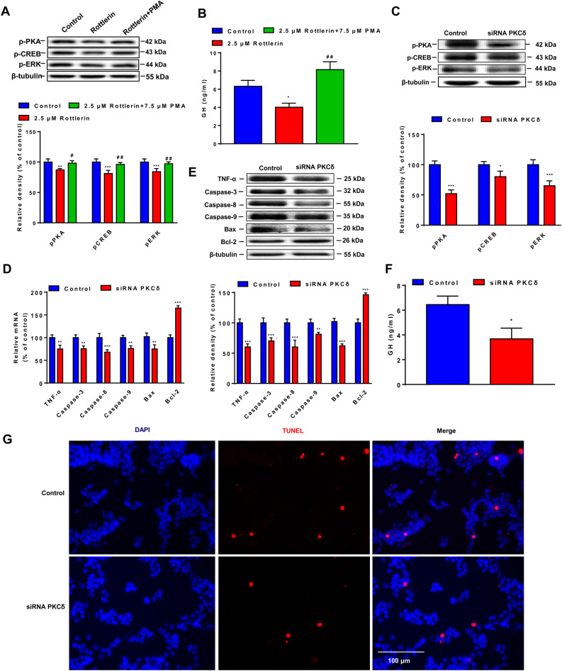 Reducing PKCδ inhibits tumor growth through growth hormone by inhibiting PKA/CREB/ERK signaling pathway in pituitary adenoma.