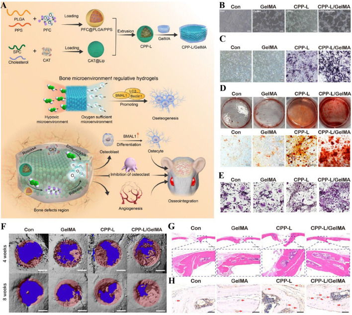Antioxidant scaffolds for enhanced bone regeneration: recent advances and challenges.