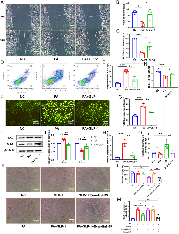 Inhibition of microRNA-139-5p by glucagon-like peptide-1 ameliorates oxidative stress-induced vascular endothelial cell damage via targeting SOD1/GCLc.