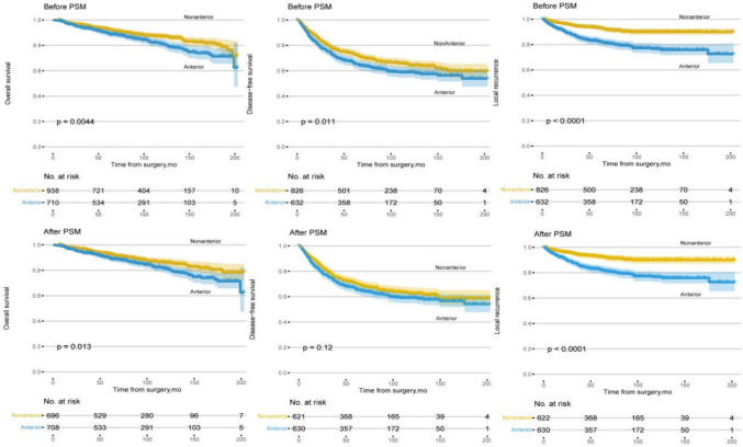 Prognostic impact of tumor location after abdominoperineal resection of rectal cancer: A single-center propensity score matching analysis based on 1806 cases.