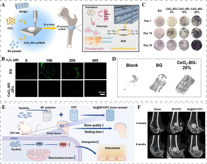 Antioxidant scaffolds for enhanced bone regeneration: recent advances and challenges.