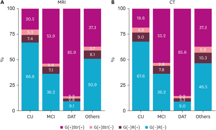 Establishing Regional Aβ Cutoffs and Exploring Subgroup Prevalence Across Cognitive Stages Using BeauBrain Amylo<sup>®</sup>.