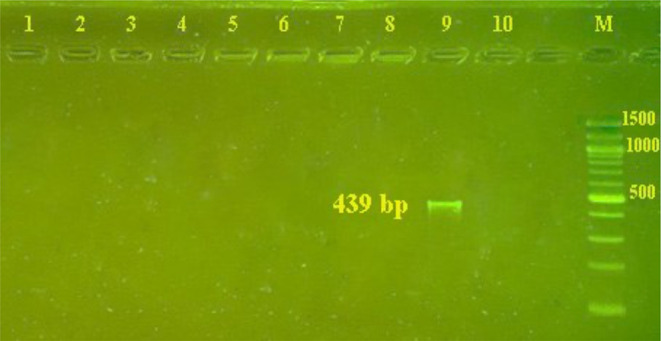 Identification of <i>Entamoeba</i> Species in Diarrheal Samples Using Sequence Analysis and Nested Multiplex PCR.