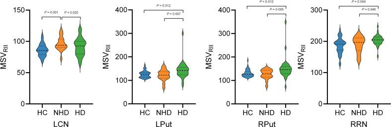 Regional high iron deposition on brain quantitative susceptibility mapping correlates with cognitive decline in chronic kidney disease patients.