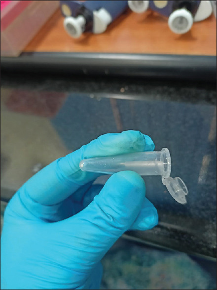 Effect of duration of fixation with formalin on mRNA expression using quantitative RT-PCR.