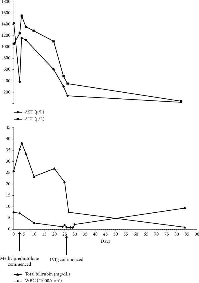 COVID-19 Challenges in Autoimmune Hepatitis Management: A Successful Outcome With Intravenous Immune Globulin (IVIg).