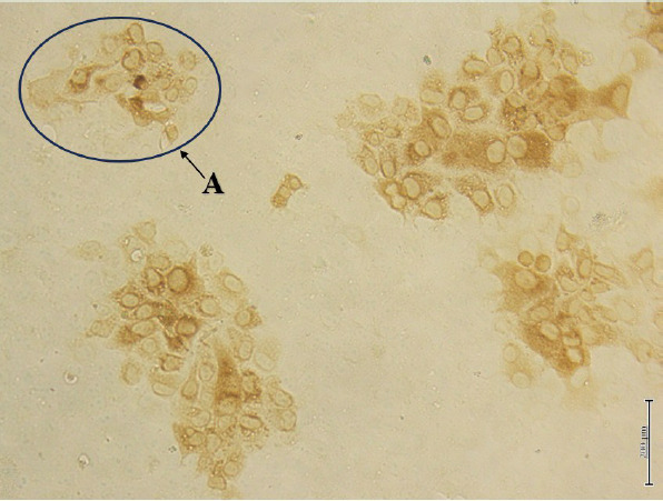 THE REPLICATION EFFICIENCY OF DENGUE VIRUS SEROTYPE 1 ISOLATED FROM PATIENTS WITH DENGUE FEVER IN HUMAN HEPATOCYTE CELL LINES.